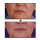 Image for article titled Joker Plastic Surgery? Permanent Duck Faces? I'm Not Sure Which!